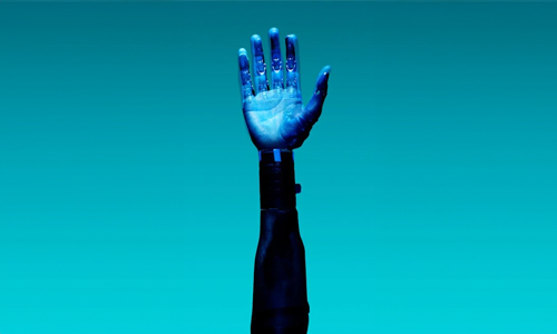 Prosthetic arm